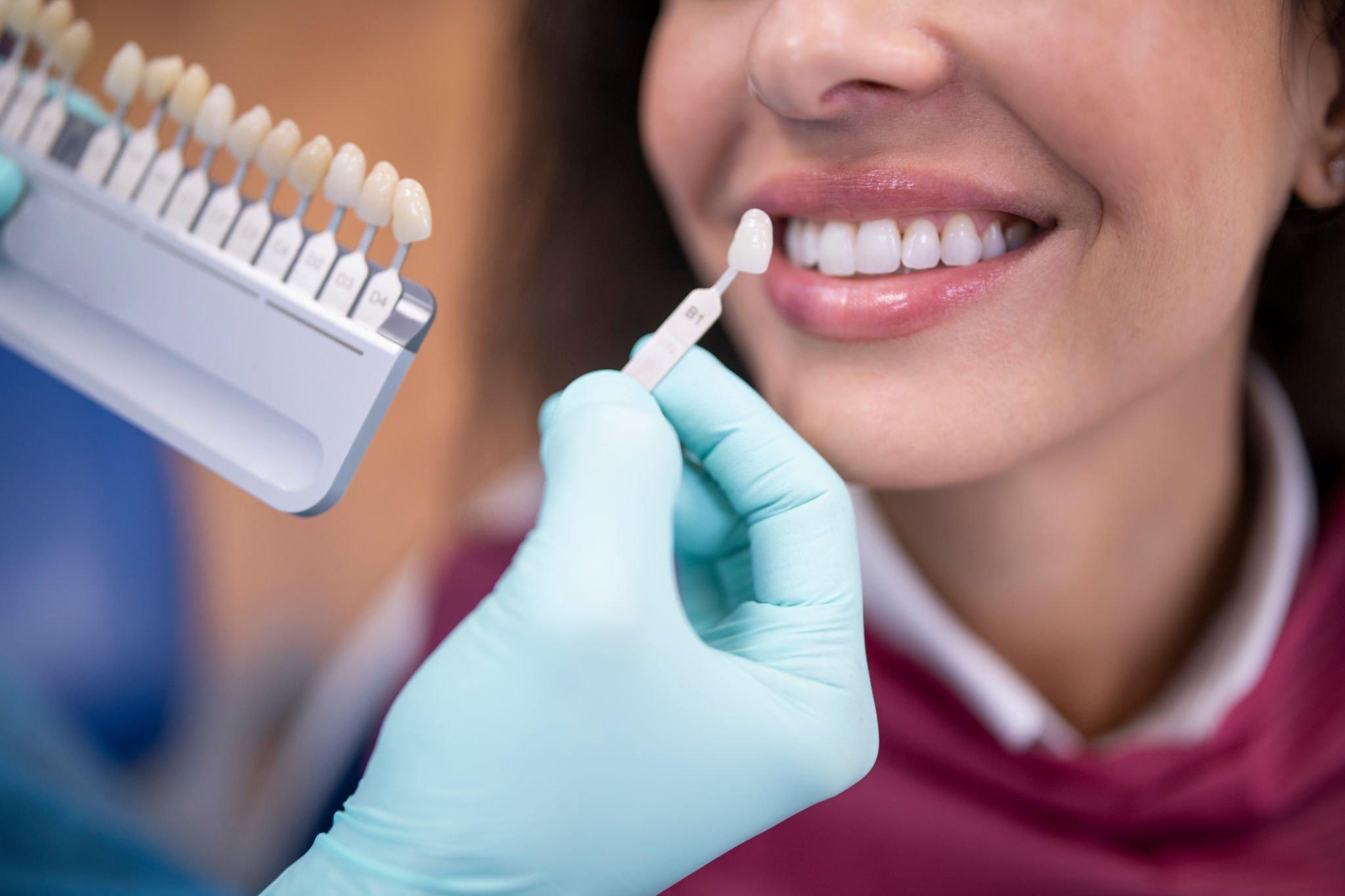 Image for Teeth Cleaning and Whitening