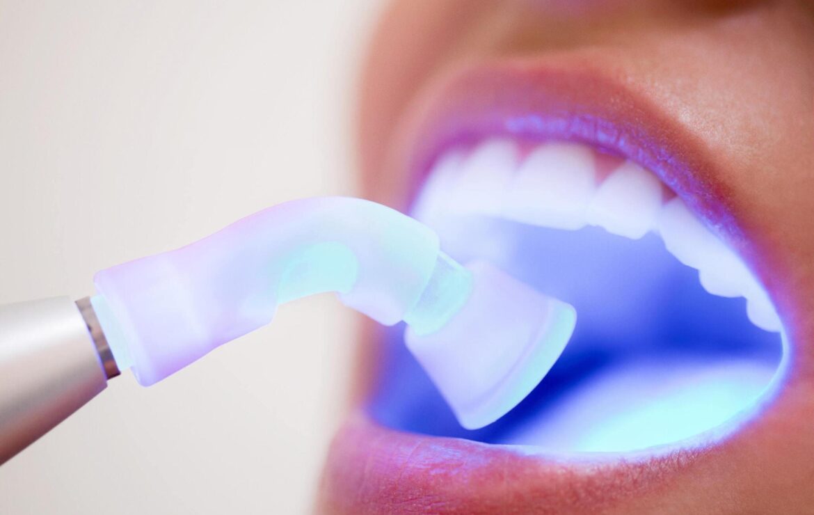 Expert Laser Dentistry in Dwarka