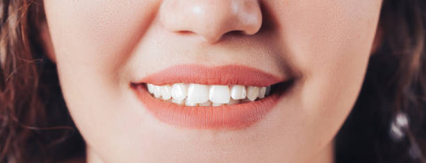 How to whiten your teeth naturally