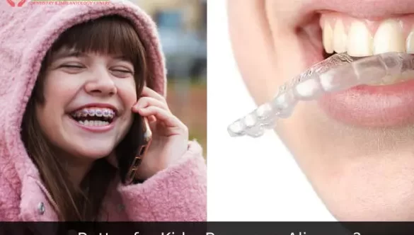 Which is Better for Kids: Braces or Aligners?