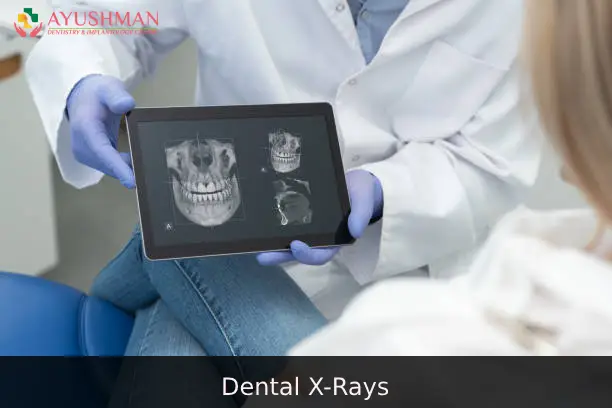 Dental X-Rays: Types, Uses & Safety