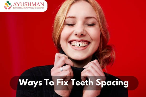 Ways To Fix Teeth Spacing | Ayushman Dentistry