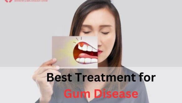 Best Treatment for Gum Disease in Dwarka: A Comprehensive Guide