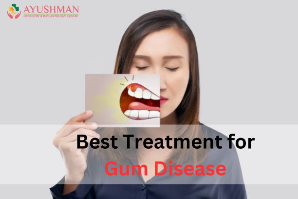 Best Treatment for Gum Disease in Dwarka: A Comprehensive Guide