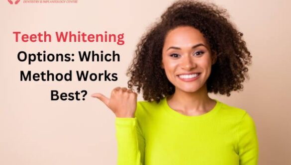 Teeth Whitening Options: Which Method Works Best?