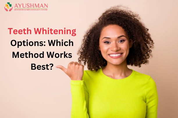 Teeth Whitening Options: Which Method Works Best?