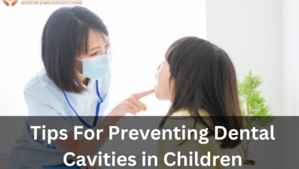 Tips For Preventing Dental Cavities in Children