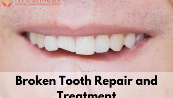 Broken Tooth Repair and Treatment