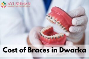 Cost of Braces in Dwarka