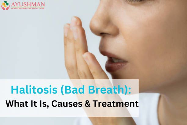 Halitosis (Bad Breath): What It Is, Causes & Treatment