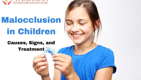 Malocclusion in Children: Causes, Signs and Treatment