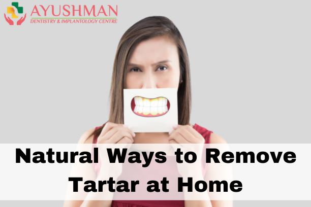 Natural Ways to Remove Tartar at Home