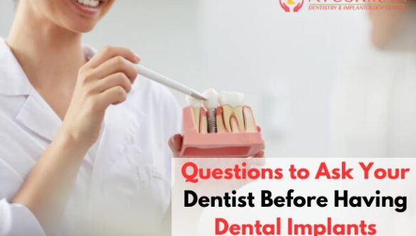 Questions to Ask Your Dentist Before Having Dental Implants