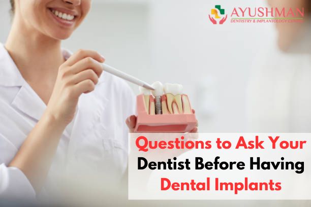 Questions to Ask Your Dentist Before Having Dental Implants