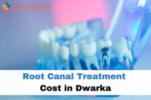 Root Canal Treatment Cost in Dwarka