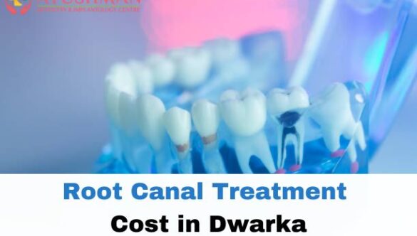 Root Canal Treatment Cost in Dwarka