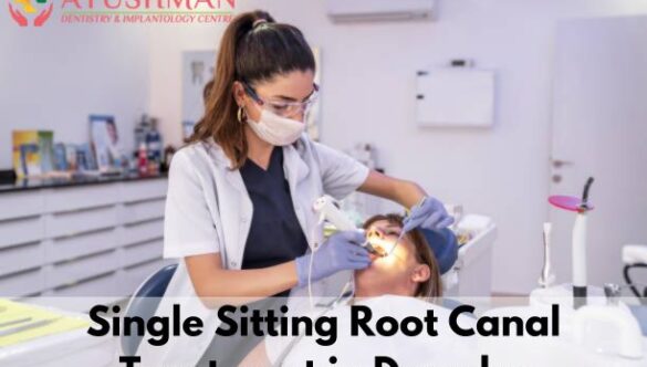 Single Sitting Root Canal Treatment in Dwarka