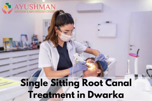 Single Sitting Root Canal Treatment in Dwarka