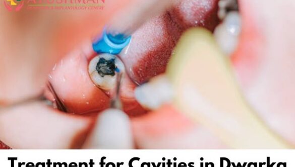 Treatment for Cavities in Dwarka