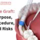 Bone Graft: Purpose, Procedure, and Risks