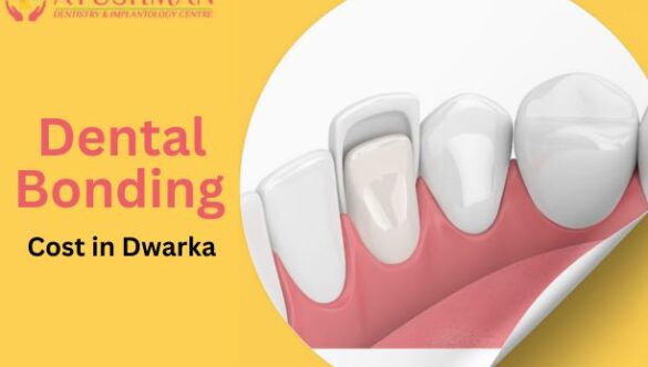 Dental Bonding Cost in Dwarka