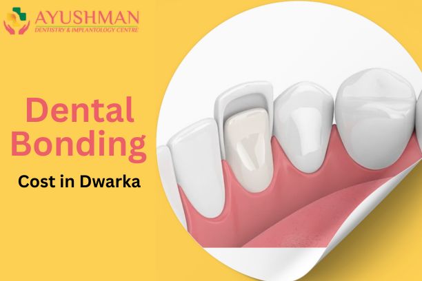 Dental Bonding Cost in Dwarka