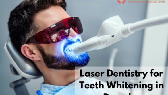 Laser Teeth Whitening in Dwarka