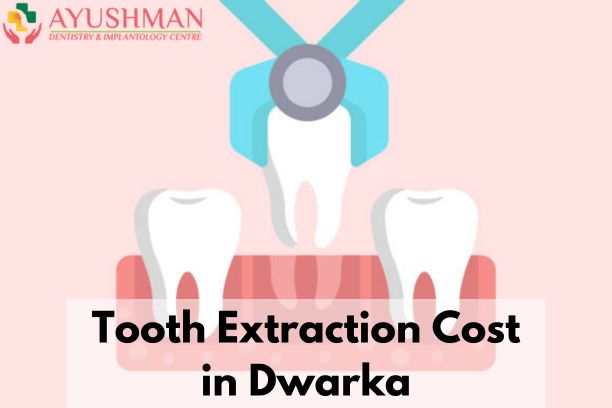 Tooth Extraction Cost in Dwarka