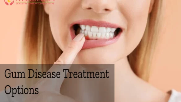 Gum Disease Treatment Options: A Comprehensive Guide