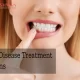 Gum Disease Treatment Options: A Comprehensive Guide