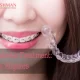 Orthodontic Treatment: Braces, Aligners, and More