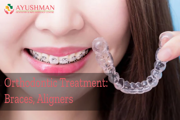 Orthodontic Treatment: Braces, Aligners, and More